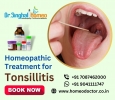 Why Choose Homeopathy for Tonsillitis?